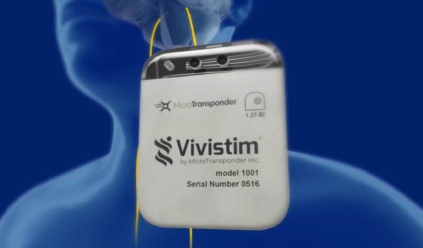 image of vivistim device