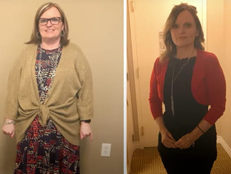 Tammy Minard before and after