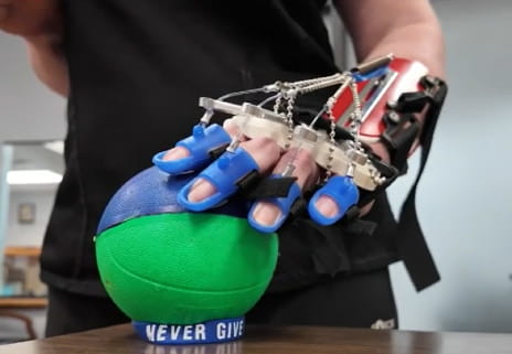 Stroke rehabilitation patient using a robotic hand therapy device to practice grip strength with a therapy ball.